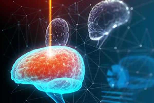 Advances in Neurophotonics for Monitoring Brain Function